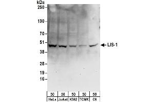 Western Blotting (WB) image for anti-Platelet-Activating Factor Acetylhydrolase 1b, Regulatory Subunit 1 (45kDa) (PAFAH1B1) (AA 1-50) antibody (ABIN7449274)