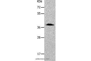 Western blot analysis of 293T cell, using PARD6A Polyclonal Antibody at dilution of 1:700