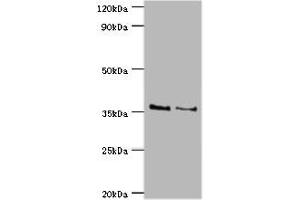 Western blot All lanes: HOXA1 antibody at 2 μg/mL Lane 1: NIH/3T3 whole cell lysate Lane 2: Hela whole cell lysate Secondary Goat polyclonal to rabbit IgG at 1/10000 dilution Predicted band size: 37, 15, 25 kDa Observed band size: 37 kDa (HOXA1 anticorps  (AA 75-205))