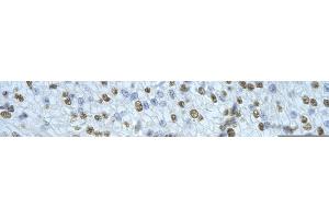 Rabbit Anti-NONO Antibody       Paraffin Embedded Tissue:  Human cardiac cell   Cellular Data:  Epithelial cells of renal tubule  Antibody Concentration:   4.