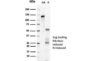 SDS-PAGE Analysis Purified p57 Recombinant Rabbit Monoclonal Antibody (KIP2/7083R).