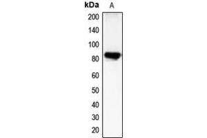 Western blot analysis of CHML expression in COLO205 (A) whole cell lysates. (CHML anticorps  (Center))