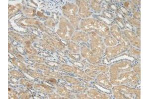 IHC-P analysis of Human Kidney Tissue, with DAB staining. (CRP anticorps  (AA 17-224))