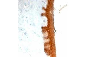 Formalin-fixed, paraffin-embedded human skin stained with Keratin 10 antibody (KRT10/844). (Keratin 10 anticorps)