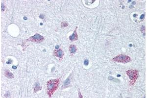 Human Brain, Cortex (formalin-fixed, paraffin-embedded) stained with WNT8B antibody ABIN351424 at 10 ug/ml followed by biotinylated goat anti-rabbit IgG secondary antibody ABIN481713, alkaline phosphatase-streptavidin and chromogen. (WNT8B anticorps  (Internal Region))