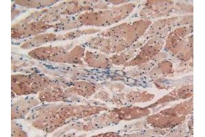 Detection of ACTa2 in Human Esophagus Tissue using Polyclonal Antibody to Actin Alpha 2, Smooth Muscle (ACTa2)