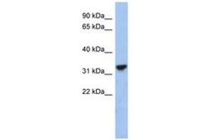 Image no. 1 for anti-Cytochrome C1 (CYC1) (C-Term) antibody (ABIN6743610) (Cytochrome C1 anticorps  (C-Term))