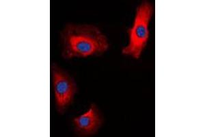 Immunofluorescent analysis of Amylin staining in HeLa cells. (Amylin/DAP anticorps  (N-Term))
