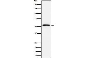 Western blot analysis of CAP1 expression in Raji cell lysate.
