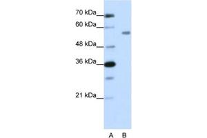 Western Blotting (WB) image for anti-Zinc Finger Protein 497 (ZNF497) antibody (ABIN2462019) (ZNF497 anticorps)