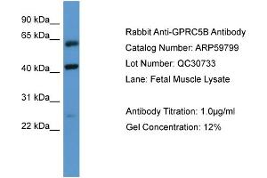 WB Suggested Anti-GPRC5B  Antibody Titration: 0. (GPRC5B anticorps  (N-Term))