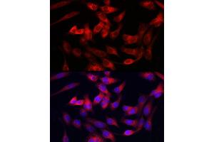 Immunofluorescence analysis of RD cells using Collagen III alpha 1/COL3 antibody (ABIN1679317, ABIN3018108, ABIN3018109 and ABIN6220366) at dilution of 1:100.