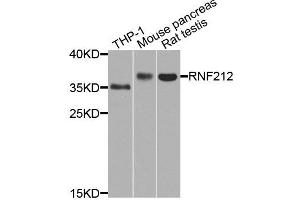 Western blot analysis of extract of various cells, using RNF212 antibody.