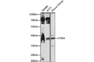 Western blot analysis of extracts of various cell lines, using CYR61 antibody (ABIN1872182) at 1:1000 dilution. (CYR61 anticorps)