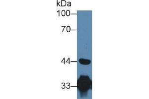 Detection of HADH in Porcine Heart lysate using Polyclonal Antibody to Hydroxyacyl Coenzyme A Dehydrogenase (HADH) (HADH anticorps  (AA 1-236))