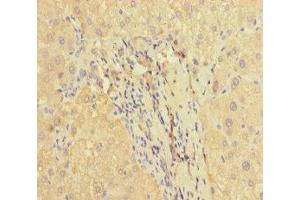 Immunohistochemistry of paraffin-embedded human liver tissue using ABIN7166464 at dilution of 1:100 (PAR1 anticorps  (AA 42-102))