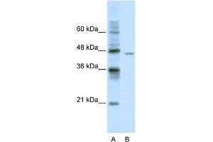 WB Suggested Anti-DDX25 Antibody Titration:  0. (DDX25 anticorps  (C-Term))