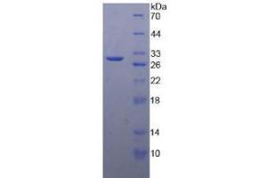 SDS-PAGE analysis of Human MMP24 Protein. (MMP24 Protéine)