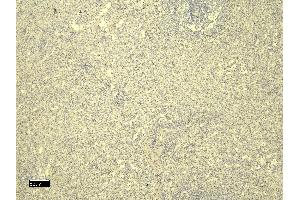 (ABIN184738) Negative Control showing staining of paraffin embedded Human Spleen, with no primary antibody.