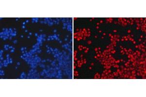 Immunofluorescence analysis of 293T cells using Asymmetric DiMethyl-Histone H3-R26 Polyclonal Antibody (Histone 3 anticorps  (H3R26me2a))