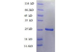 ATumor Necrosis Factor Ligand Superfamily Member 9 (AA 52-254), (partial) protein (His tag)