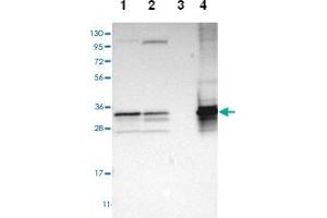 Western blot analysis of Lane 1: Human cell line RT-4, Lane 2: Human cell line U-251MG sp, Lane 3: Human plasma (IgG/HSA depleted), Lane 4: Human liver tissue with TST polyclonal antibody  at 1:100-1:250 dilution. (TST anticorps)