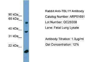 WB Suggested Anti-TBL1Y  Antibody Titration: 0. (TBL1Y anticorps  (Middle Region))