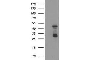 Western Blotting (WB) image for anti-ELK3, ETS-Domain Protein (SRF Accessory Protein 2) (ELK3) antibody (ABIN1498005) (ELK3 anticorps)