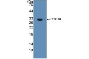 Detection of Recombinant FOXO3, Human using Polyclonal Antibody to Forkhead Box Protein O3 (FOXO3) (FOXO3 anticorps  (AA 369-633))