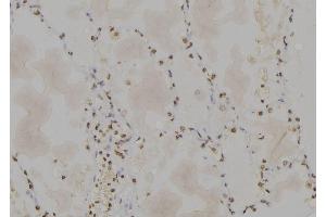 ABIN6277166 at 1/100 staining Human lung tissue by IHC-P.