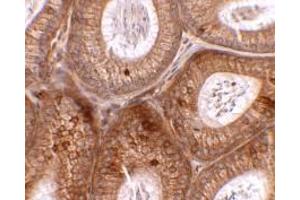 Immunohistochemistry of SPINK2 in mouse testis tissue with SPINK2 antibody at 2. (SPINK2 anticorps  (C-Term))