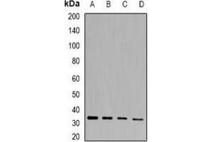 Western blot analysis of PHYHD1 expression in mouse heart (A), mouse skin (B), rat liver (C), rat kidney (D) whole cell lysates.