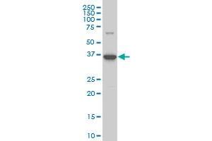 BOLL monoclonal antibody (M14), clone 1G3 Western Blot analysis of BOLL expression in Y-79 .