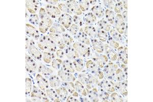 Immunohistochemistry of paraffin-embedded rat stomach using KPN Rabbit pAb (ABIN6131812, ABIN6142991, ABIN6142992 and ABIN6224371) at dilution of 1:100 (40x lens).