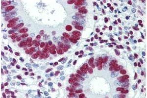 Human Uterus: Formalin-Fixed, Paraffin-Embedded (FFPE)