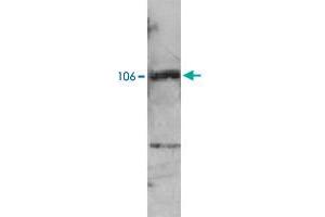 Western blot analysis of extracts from NB4 cells using PML polyclonal antibody . (PML anticorps)