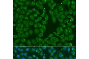 anti-Methionine Sulfoxide Reductase B3 (MSRB3) antibody