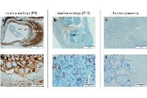 Immunohistochemical staining of PlGF in paraffin-embedded mouse placenta embryo (a and b) showing intense cytoplasmic staining in mouse placenta at E9. (PLGF anticorps  (AA 24-158))