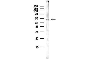 anti-Muscarinic Acetylcholine Receptor M1 (CHRM1) (C-Term) antibody