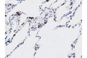 Immunohistochemistry (IHC) image for anti-DnaJ (Hsp40) Homolog, Subfamily A, Member 2 (DNAJA2) antibody (ABIN1497859) (DNAJA2 anticorps)