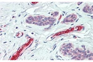 Detection of HBb in Human Breast Tissue using Polyclonal Antibody to Hemoglobin Beta (HBb)