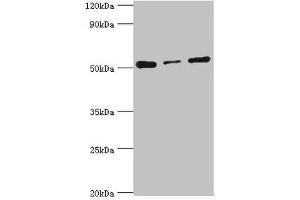 Western blot All lanes: Programmed cell death protein 4 antibody at 4 μg/mL Lane 1: Hela whole cell lysate Lane 2: MCF-7 whole cell lysate Lane 3: Jurkat whole cell lysate Secondary Goat polyclonal to rabbit IgG at 1/10000 dilution Predicted band size: 52, 51 kDa Observed band size: 52 kDa (PDCD4 anticorps  (AA 1-260))
