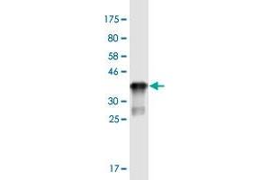 ST3GAL5 anticorps  (AA 31-117)