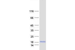 Validation with Western Blot