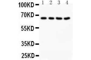 Anti-NOX1 antibody, Western blotting Lane 1: Rat Heart Tissue Lysate Lane 2: Rat Brain Tissue Lysate Lane 3: Mouse Heart Tissue Lysate Lane 4: Mouse Heart Tissue Lysate