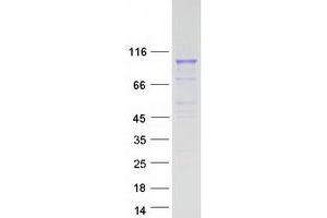 Validation with Western Blot
