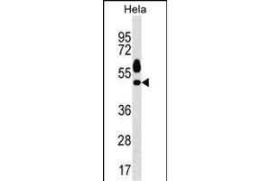 Mouse Sgk1 Antibody (C-term) (ABIN1537130 and ABIN2850307) western blot analysis in Hela cell line lysates (35 μg/lane).