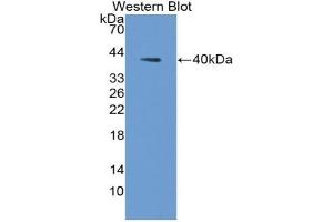 Detection of Recombinant AQP2, Human using Polyclonal Antibody to Aquaporin 2, Collecting Duct (AQP2)