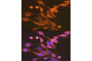 Immunofluorescence analysis of NIH-3T3 cells using Xanthine Oxidase (XDH) (XDH) Rabbit mAb (ABIN7271408) at dilution of 1:100 (40x lens). (XDH anticorps)