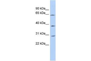 WB Suggested Anti-CCDC54 Antibody Titration: 0. (CCDC54 anticorps  (N-Term))